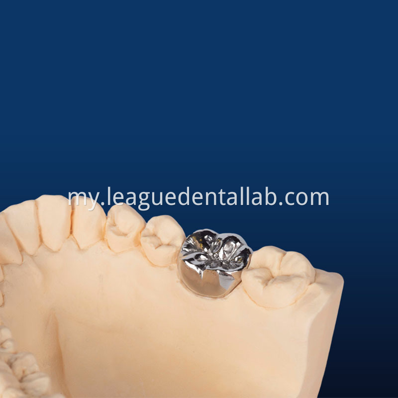 Full Gold crown,Full metal crown Non-precious, Full Metal crown Non-precious Yellow